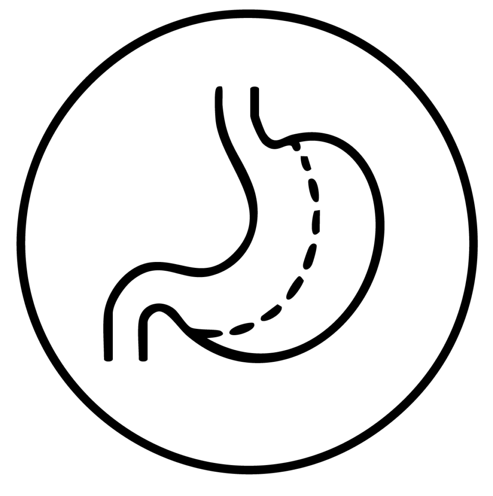 Icono de Manga gástrica